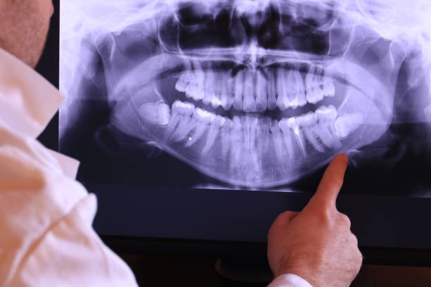 Best Root Canal Emergency Dentist  in Salem, NC